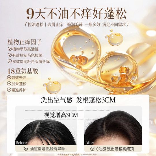 氨基酸洗发水控油蓬松去屑止痒官方正品牌洗头膏露男女士洗护套装