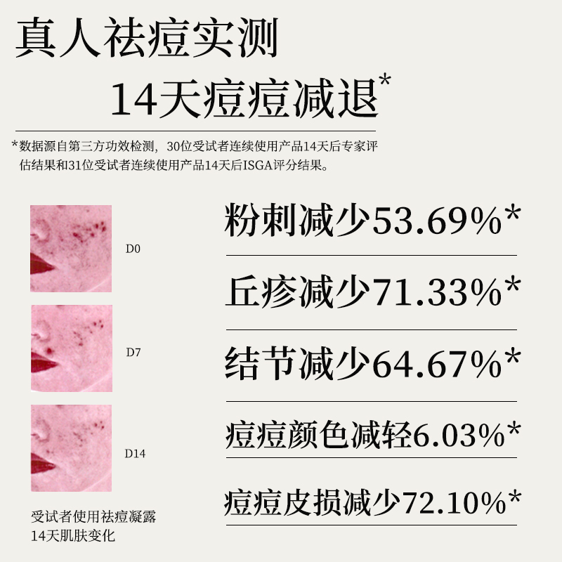 寻荟记茶树祛痘膏正品 淡化痘印痘坑痘疤芦荟胶 祛痘凝胶男女学生 - 图1