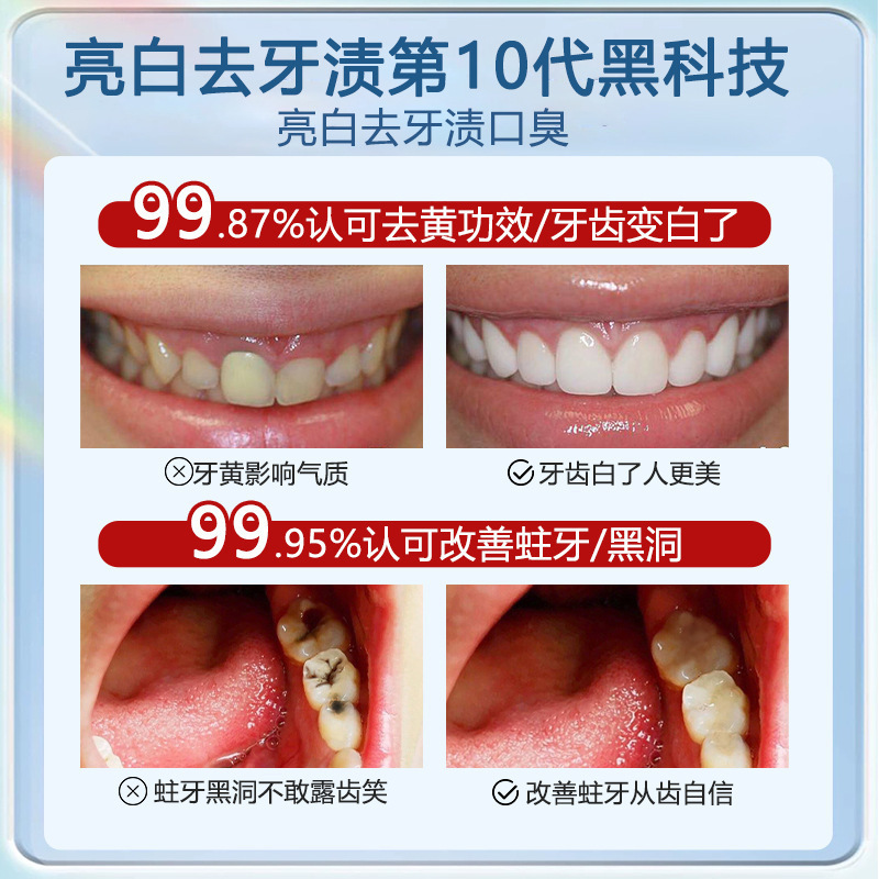 多源春雨树益生菌亮白牙膏正品抗敏美白去口臭牙膏热销榜清新口气-图1