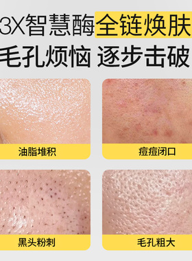 羽素清肌焕肤面膜祛痘去粉刺修护