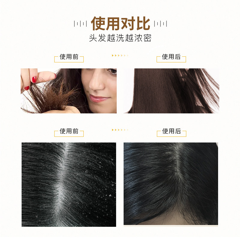 韩纪轻柔顺滑氨基酸滋润止痒洗发露 韩纪洗发水