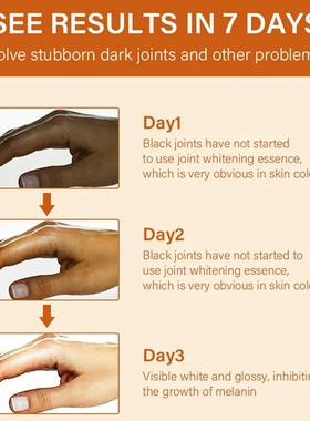 DarkKnucklesWhiteningSerum