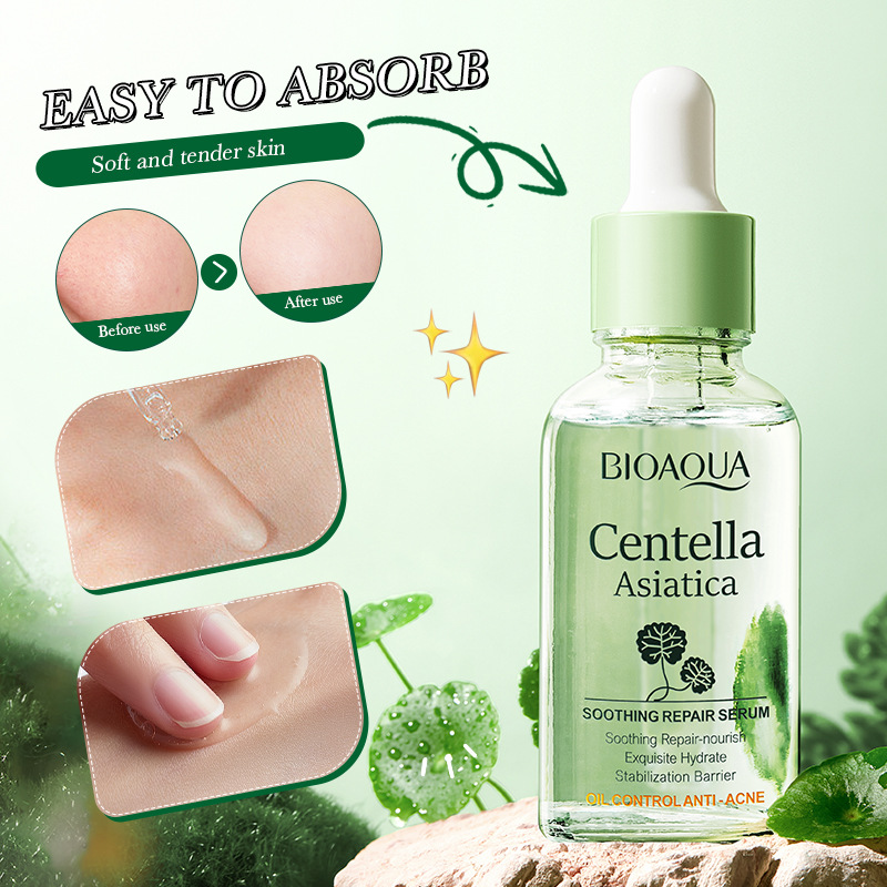 Centella Asiatica Acne Removing Essence Face Serum精华液痘痘 - 图0