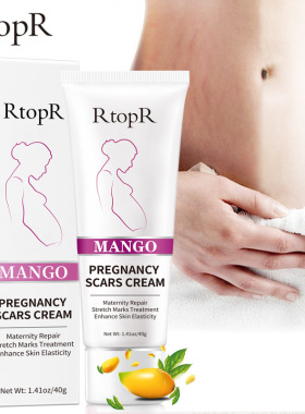 RemoveStretchMarkCream面霜