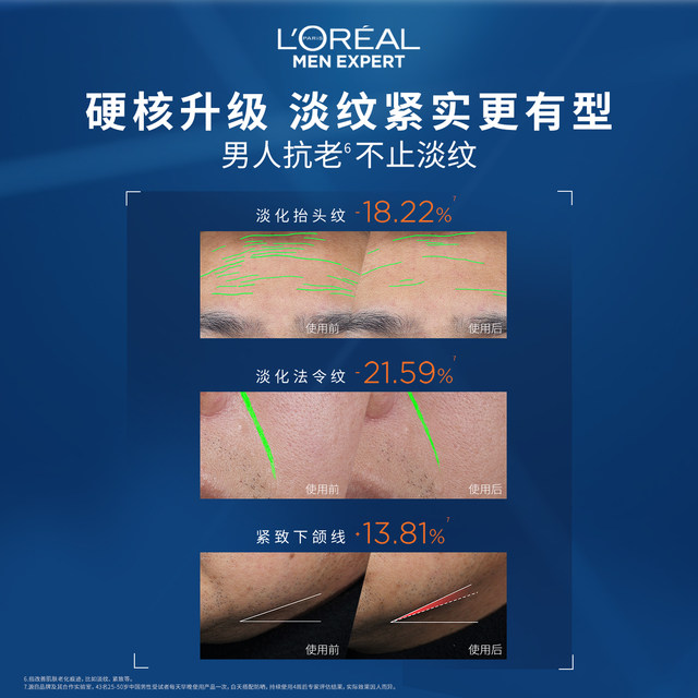 L'Oreal Men's Anti-Wrinkle Set Firming Moisturizing Facial Cleanser Water Emulsion Skin Care