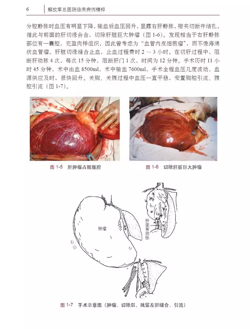 放军总医院临床病例精粹 第3辑 消化道癌肺癌专辑 存活10年以上 顾倬云 解放军总医院专家对病例的讨论及点评 科学出版社