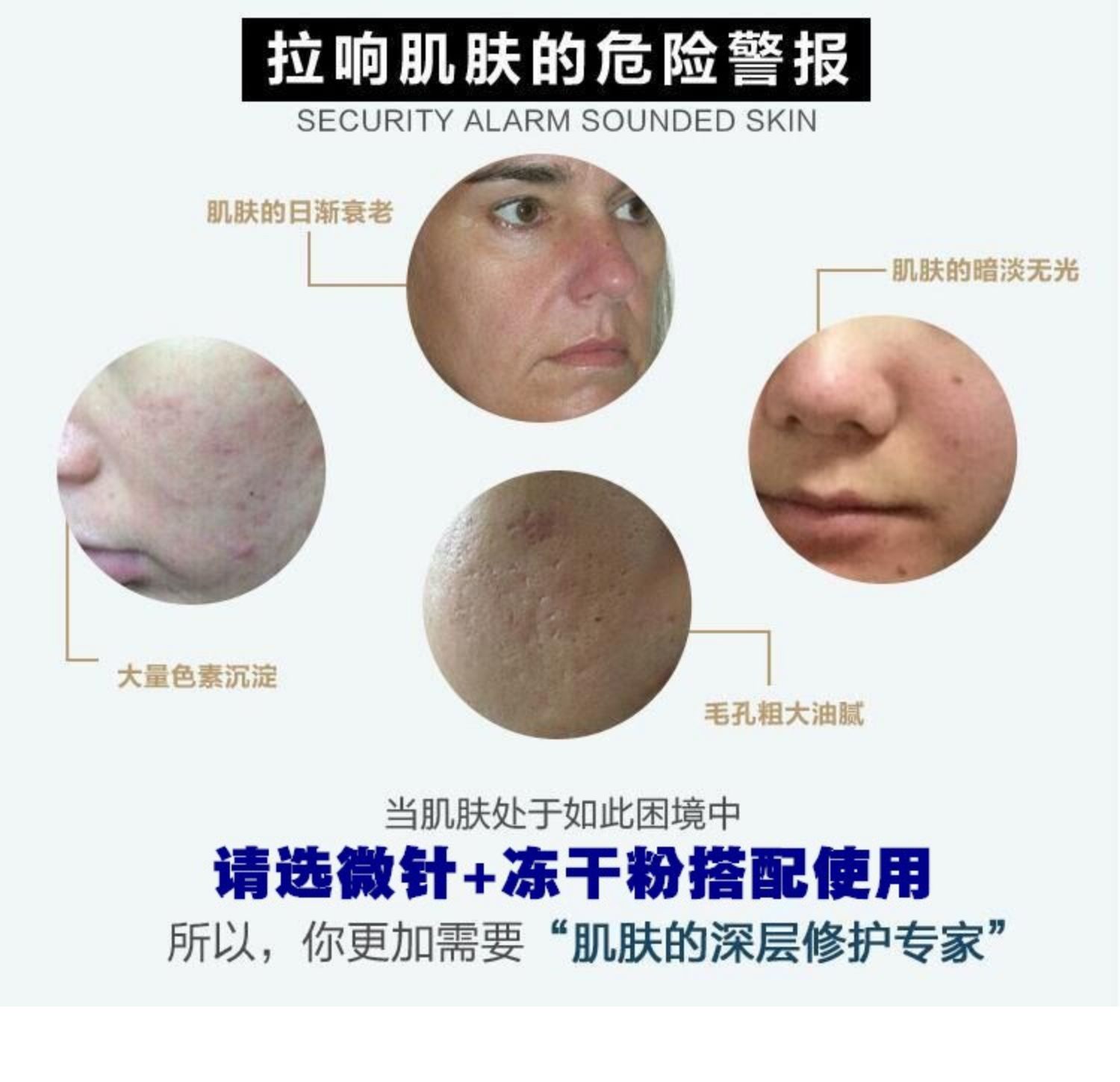 纳米微针水光枪电动微晶出水导入仪器中胚补水溶斑痘坑美容院家用 - 图1