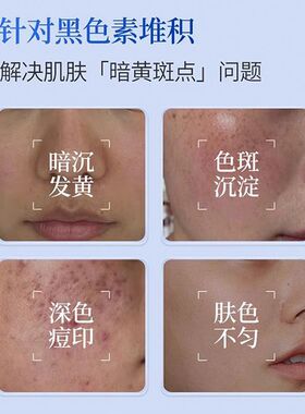 BNY珀耐妍美白祛斑霜去黄提亮补水保湿淡化色斑改善暗沉修护面霜