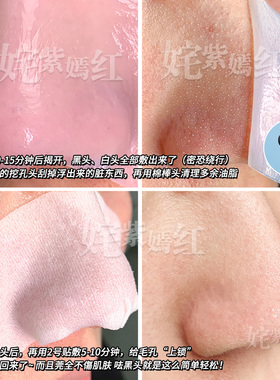RNW去黑头鼻贴导出液收缩贴毛孔清洁温和男女草莓鼻1盒