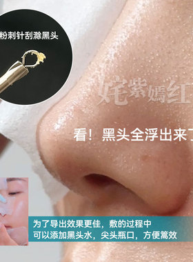 ilso一苏黑头导出液去黑头控油