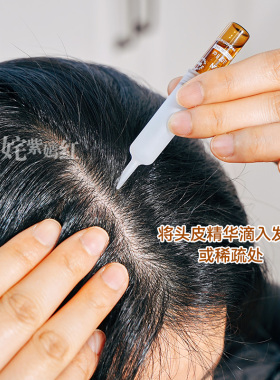 英诺小棕瓶头皮精华固发防脱