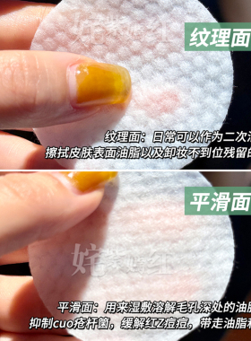 【订阅享惊喜价】rnw水杨酸棉片