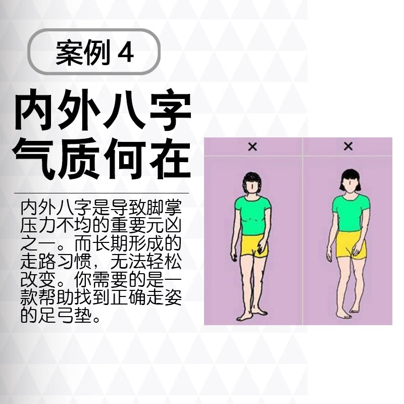 日本足弓垫鞋垫OX型腿足底矫形小腿外翻内高扁平足支撑脚垫矫正器 - 图2