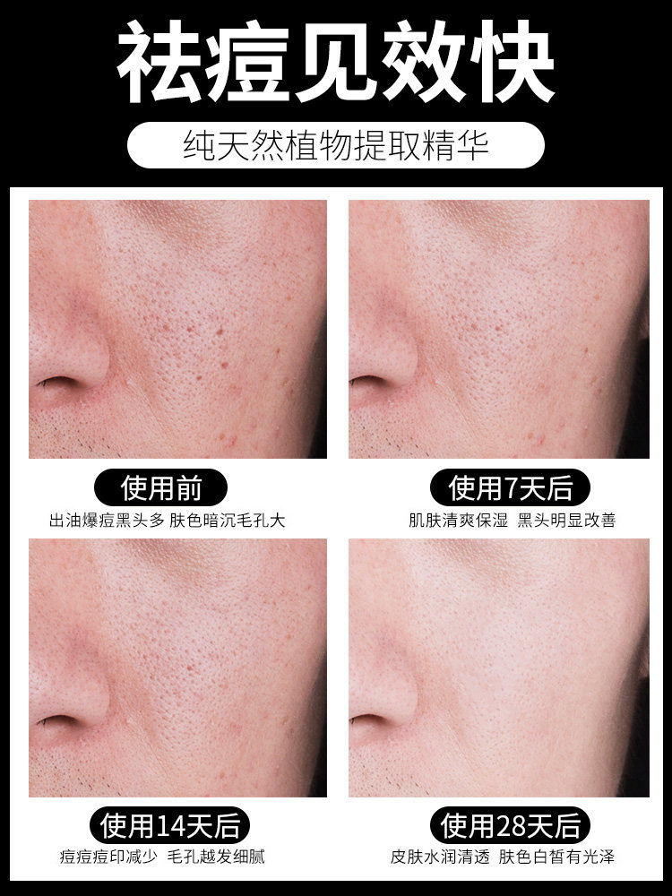 曼秀雷敦洗面奶男士专用抗痘氨基酸 曼秀雷敦美妆男士洁面