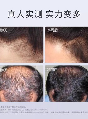 Hairmax82光束低能量红光生发仪生发带健发梳增发仪器生发帽头盔