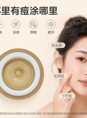 老中医痘清霜青春痘闭口粉刺面霜