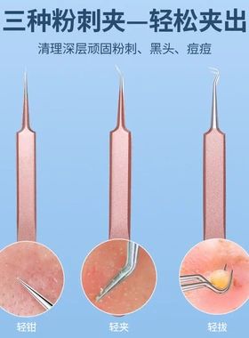 妮兰斯超尖细胞夹套装去黑头粉刺针挤痘痘美容院用镊子黑头夹套装