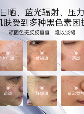 蝶莲娜α熊果苷烟酰胺传明酸高阶美白淡斑抗皱乳霜三甲皮肤专用