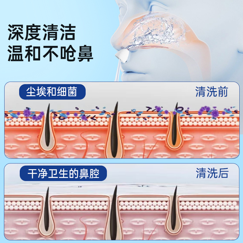 诺斯清电动洗鼻器家用鼻腔冲洗器儿童成人专用双模式家用清洗器