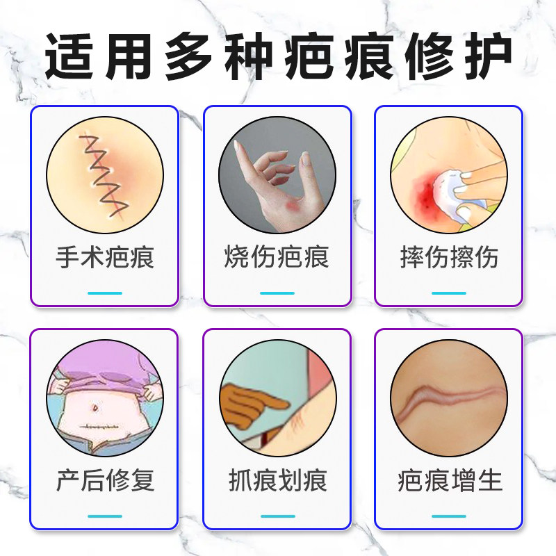 疤克去疤痕修复手术儿童巴克祛疤膏 国信大药房祛疤产品