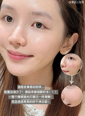 TO烟酰胺精华美白控油收毛孔