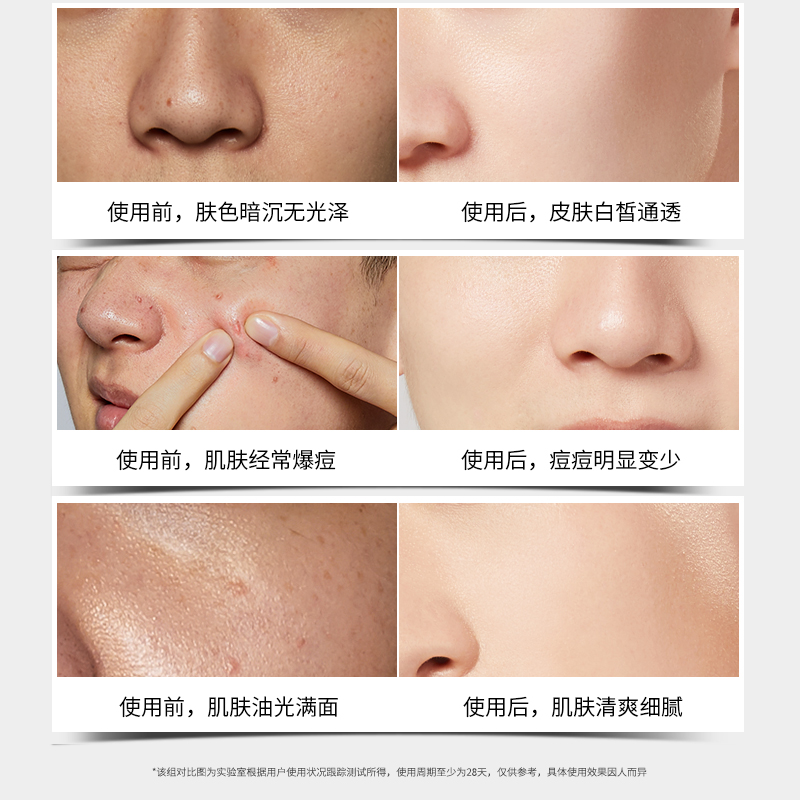 资莱皙旗舰店美白男士护肤套装正品控油补水保湿祛痘洗面奶洗脸水乳全套化妆品2