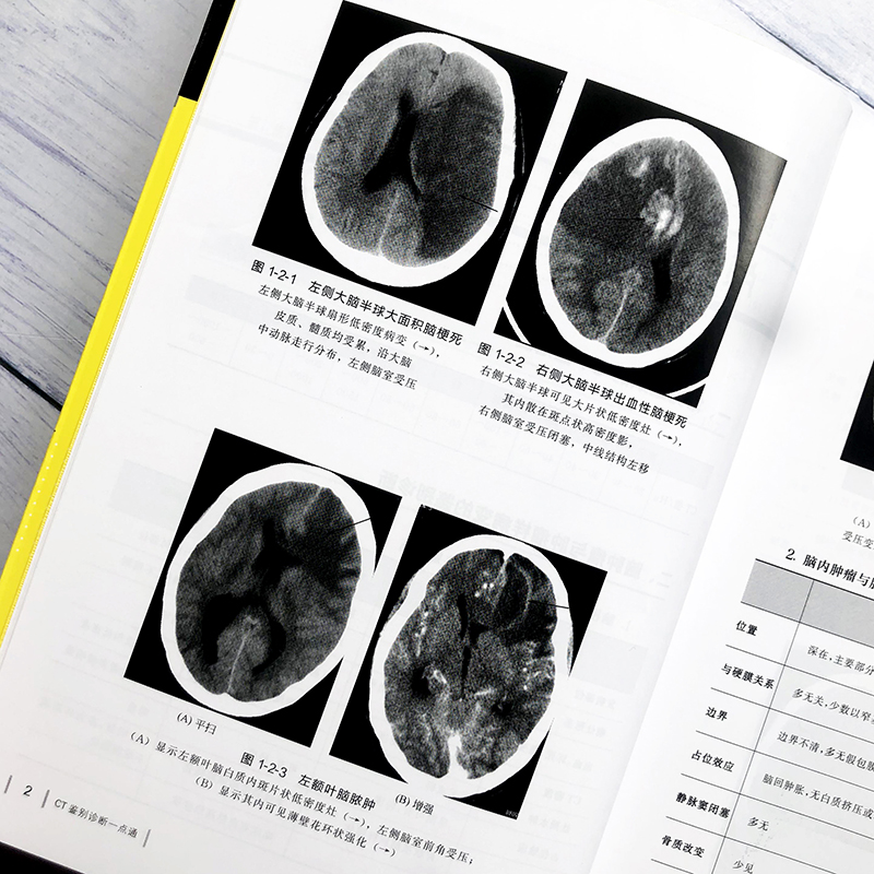 影像鉴别诊断CT鉴别诊断一点通 ct诊断与临床ct影像诊断学医学影像诊断学医学影像学读片诊断图谱导图式医学影像鉴别诊断参考书籍-图0