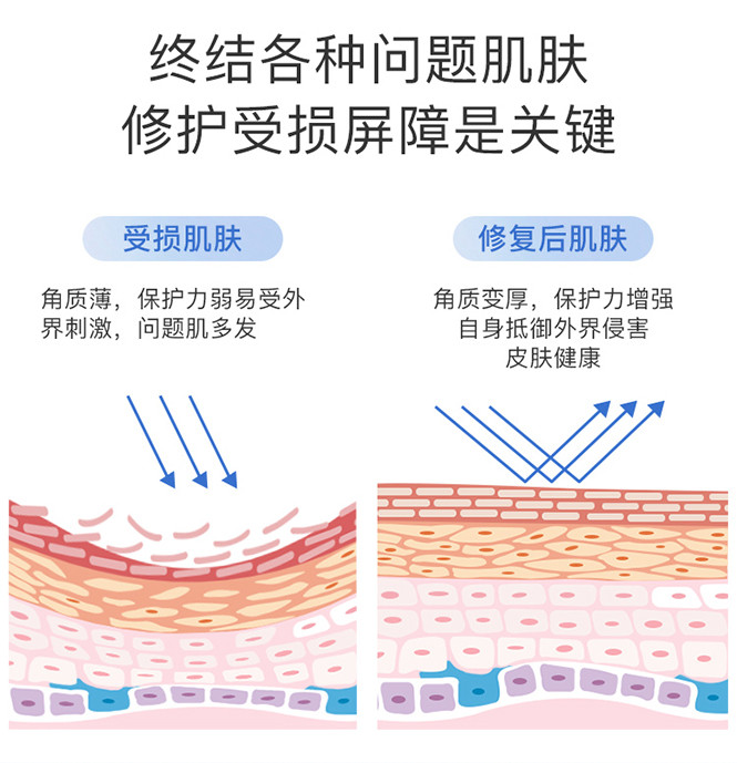 瓷妆依克多因舒润特护精华液美皙泉套装强白皙细嫩修护屏障去红