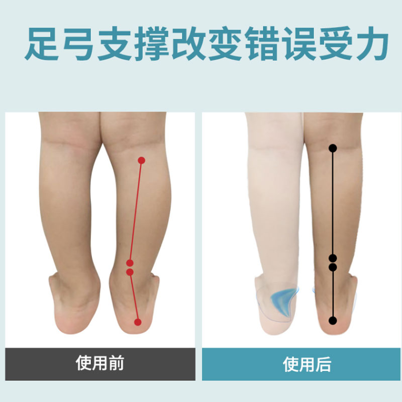 儿童扁平足弓矫正鞋垫塌陷足外翻平底足矫形支撑训练小神器软硅胶-图1