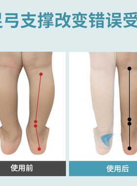 矫正鞋垫儿童扁平足弓支撑足外翻