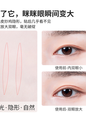 橄榄型双眼皮贴女内双