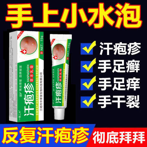 汗泡疱疹药膏手上起小水泡汗状疱疹止痒汉状真菌感染手气专用软膏 - 图0