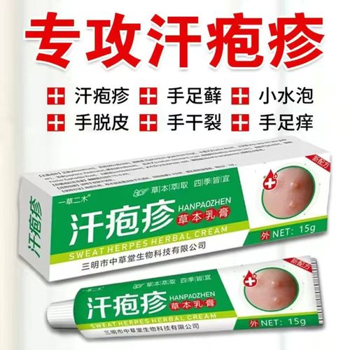 汗泡疱疹药膏手上起小水泡汗状疱疹止痒汉状真菌感染手气专用软膏 - 图3
