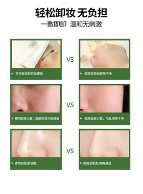 MCC眼唇卸妆液敏感肌温和零伤害