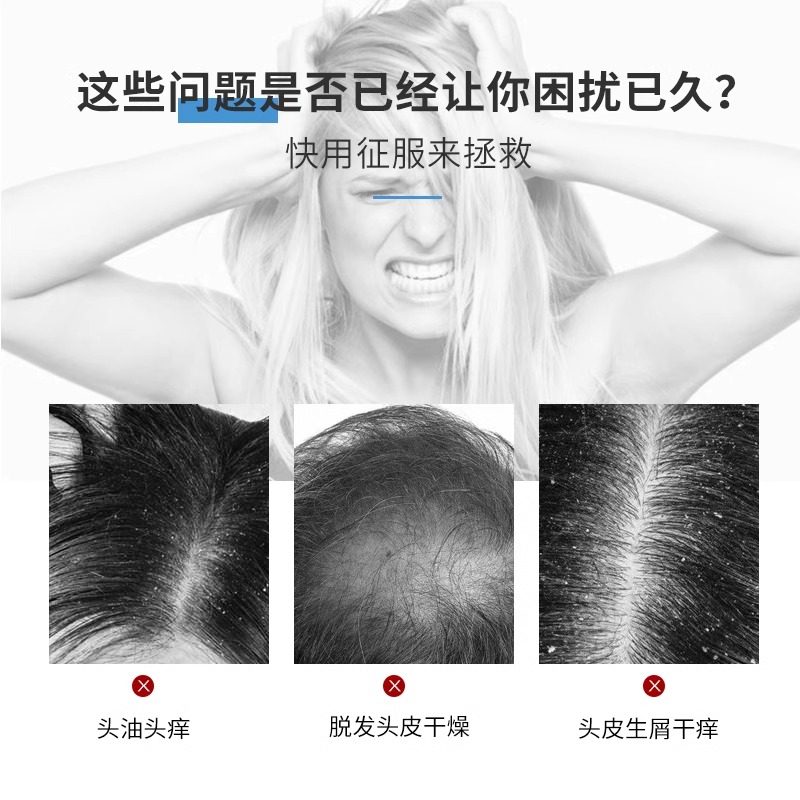 征服青蒿洗发水去屑止痒洗发乳生姜养发清洁头皮旅行装190ml清仓,淘宝优惠券,粉丝福利购,淘宝优惠卷