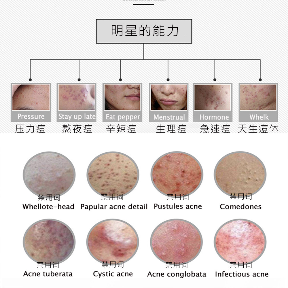 诊所美容院专用刷酸水杨酸30%果酸家用焕肤棉片面膜套装中和液TCA,淘宝优惠券,粉丝福利购,淘宝优惠卷