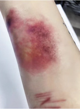 万圣节受伤妆纹身贴脸贴