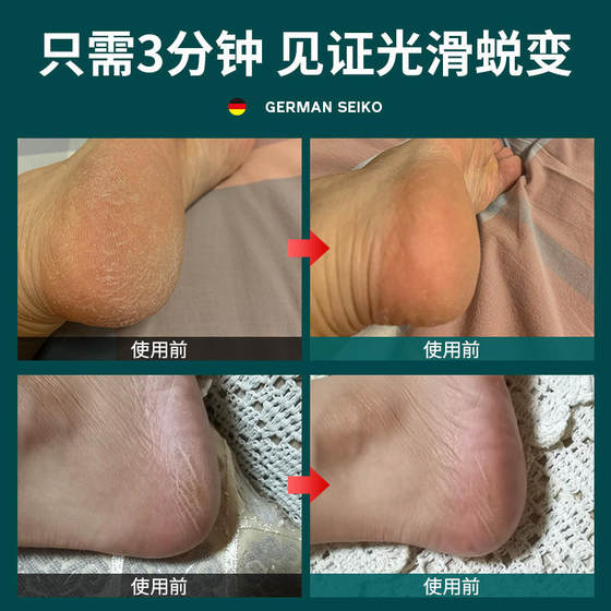 Pedicure tool to remove dead skin and wash your feet