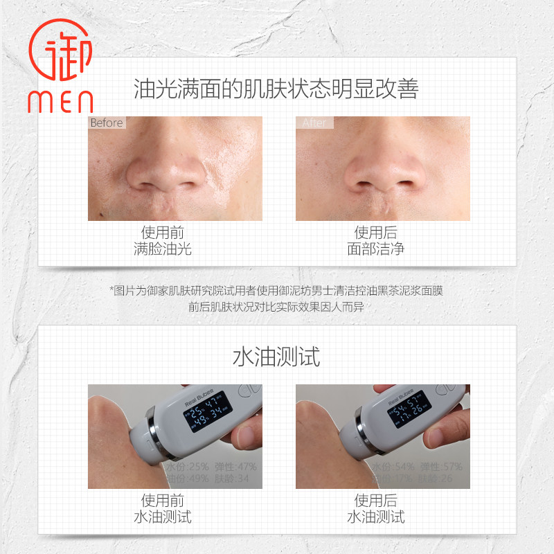 御泥坊男士御men控油收缩毛孔正品 御泥坊湖南男士面膜