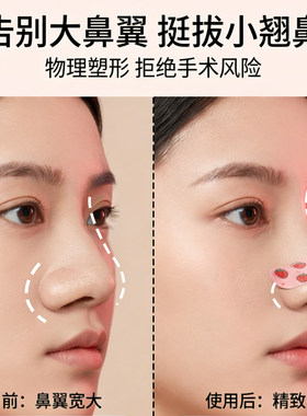 翘鼻贴记忆龙骨鼻子塑形可调节随心缩鼻蒜头鼻收鼻翼缩小鼻梁增高