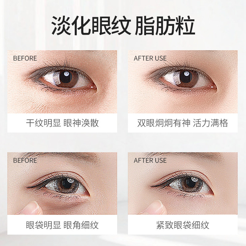 黄金贵妇淡化细纹黑眼圈消眼膜贴 碧素堂碧莹眼膜