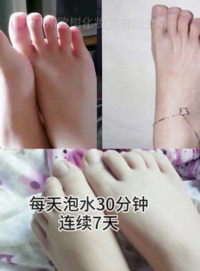 去角质足膜脚膜老茧脚干裂脱皮脚后跟去死皮嫩滑补水足部护理套装