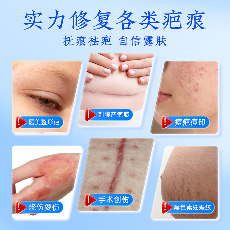 修正疤痕贴祛疤膏修复除疤膏剖腹产医用硅酮凝胶增生凸起去除疙瘩 - 图1