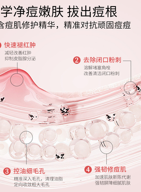 壬二酸凝胶祛痘修复淡化痘印去黑色素沉淀水杨酸收缩毛孔精华