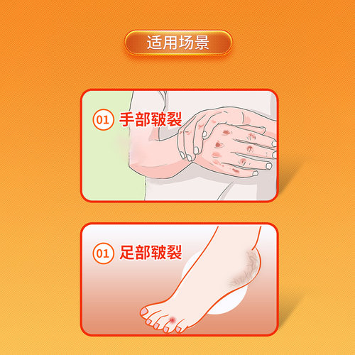 信龙尿素维E乳膏VE医用复方外用尿素霜手足皲裂正品药膏维生素OTC - 图1