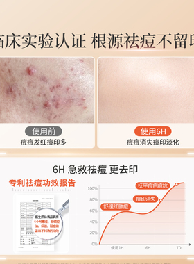祛痘印修复淡化痘印痘坑痘疤痘痕去痘印红肿脓痘痘膏水杨酸精华液