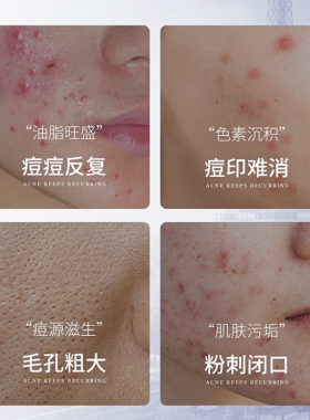 左旋维c冻干片vc固态维生素c粉加烟酰胺提亮精华液官方旗舰店正品
