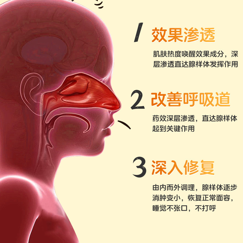 葵花腺样体肥大贴儿童调理面容矫正器小儿保健小孩发炎