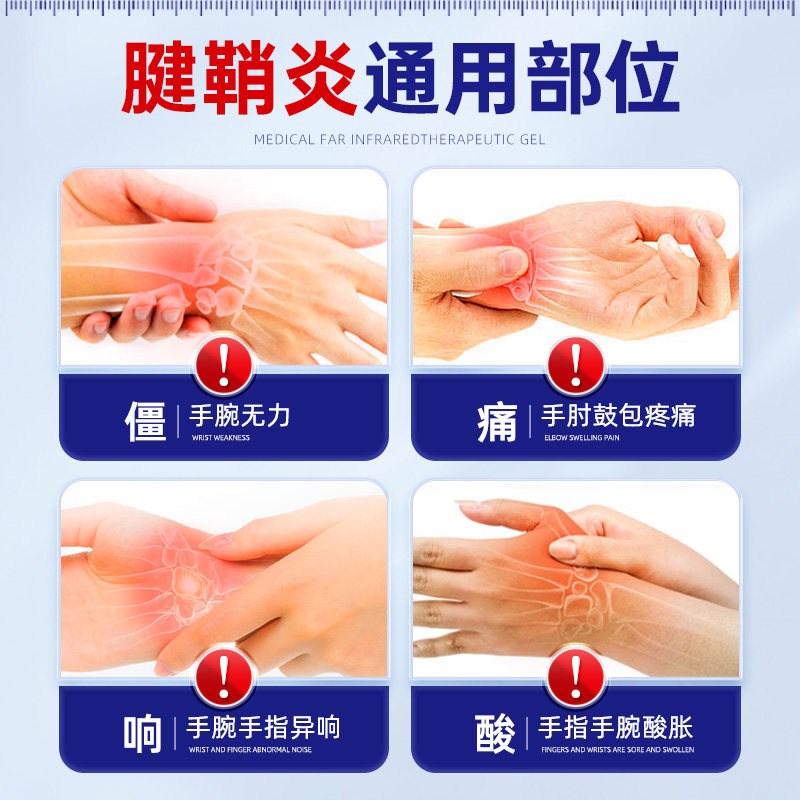 腱鞘炎贴膏治喷剂疗手指变形凝胶网球肘护腕手腕官方正品远红外
