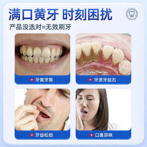 美白去黄改善牙齿口臭抗敏感洗白去烟渍牙垢牙结石牙科分离剂医用 - 图0